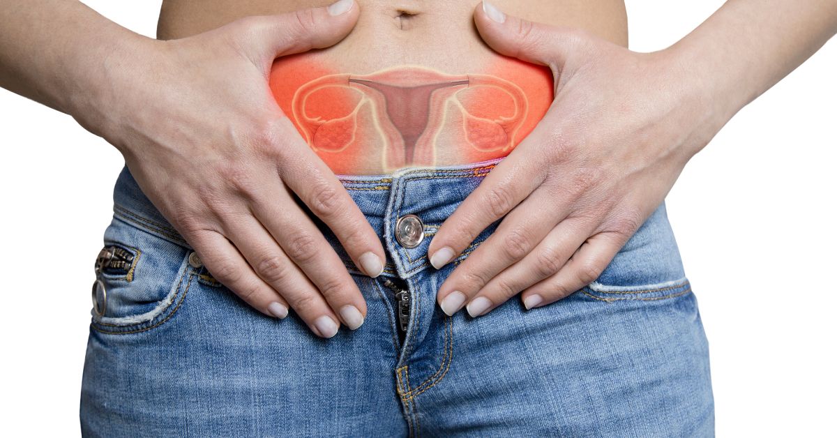 Chist ovarian: tipuri, simptome și când este nevoie de tratament